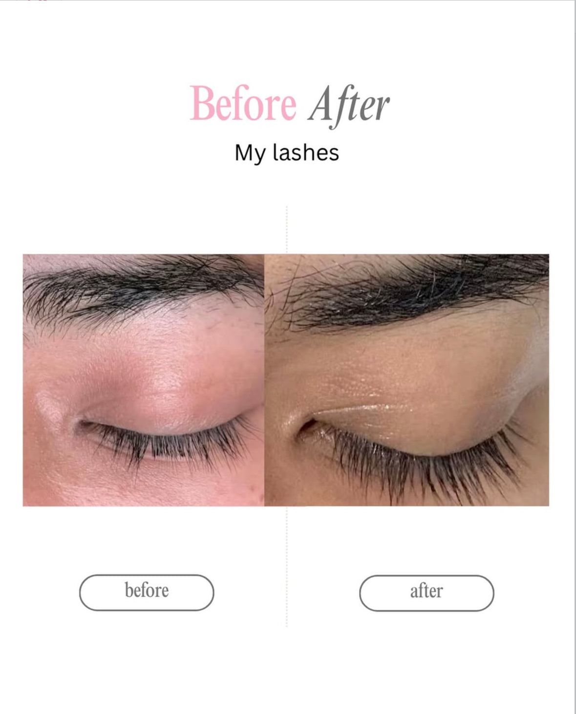 Serum My Lashes – Pestañas Más Largas en 4 Semanas🩷 ‼️