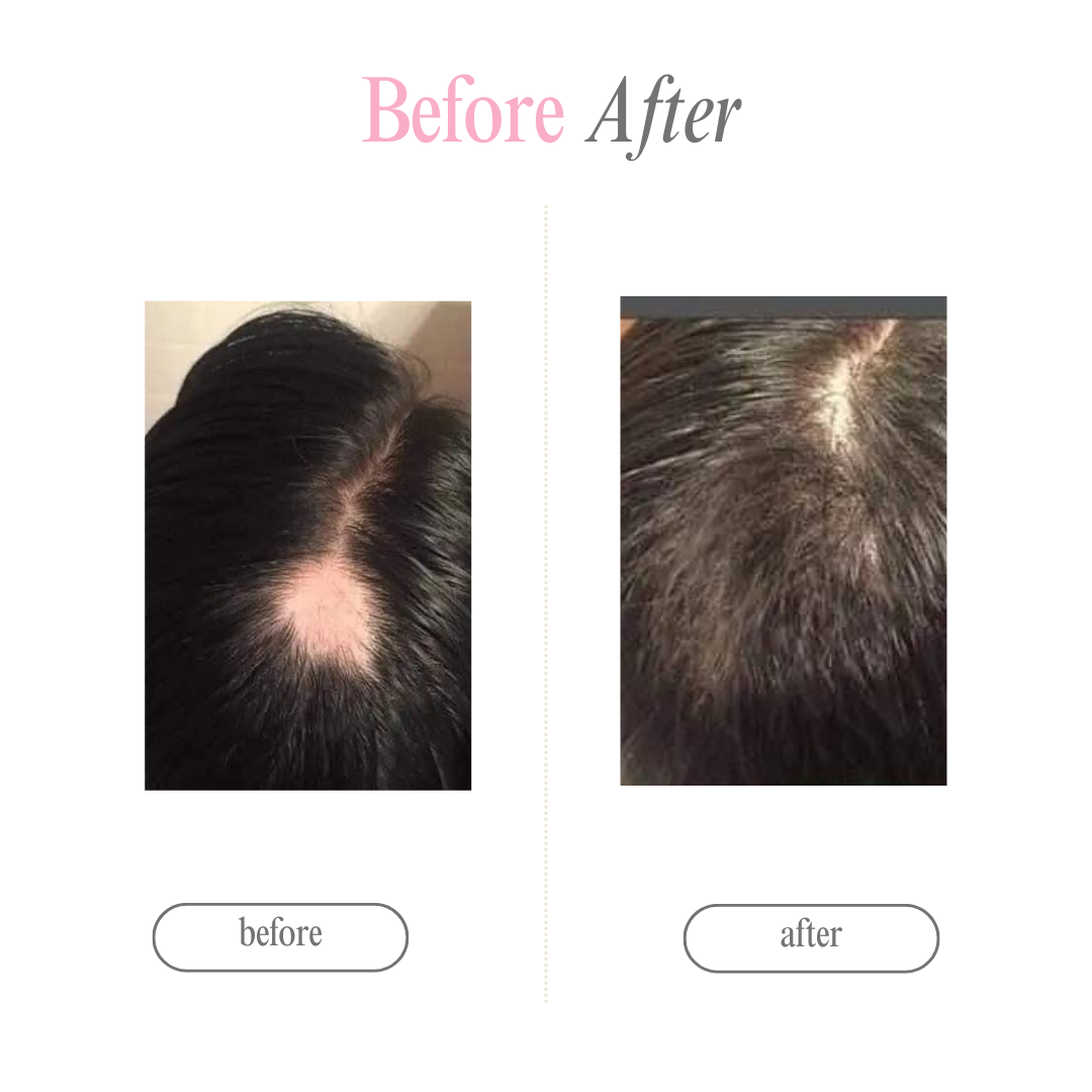 DUO CRECIMIENTO Y REPARACION