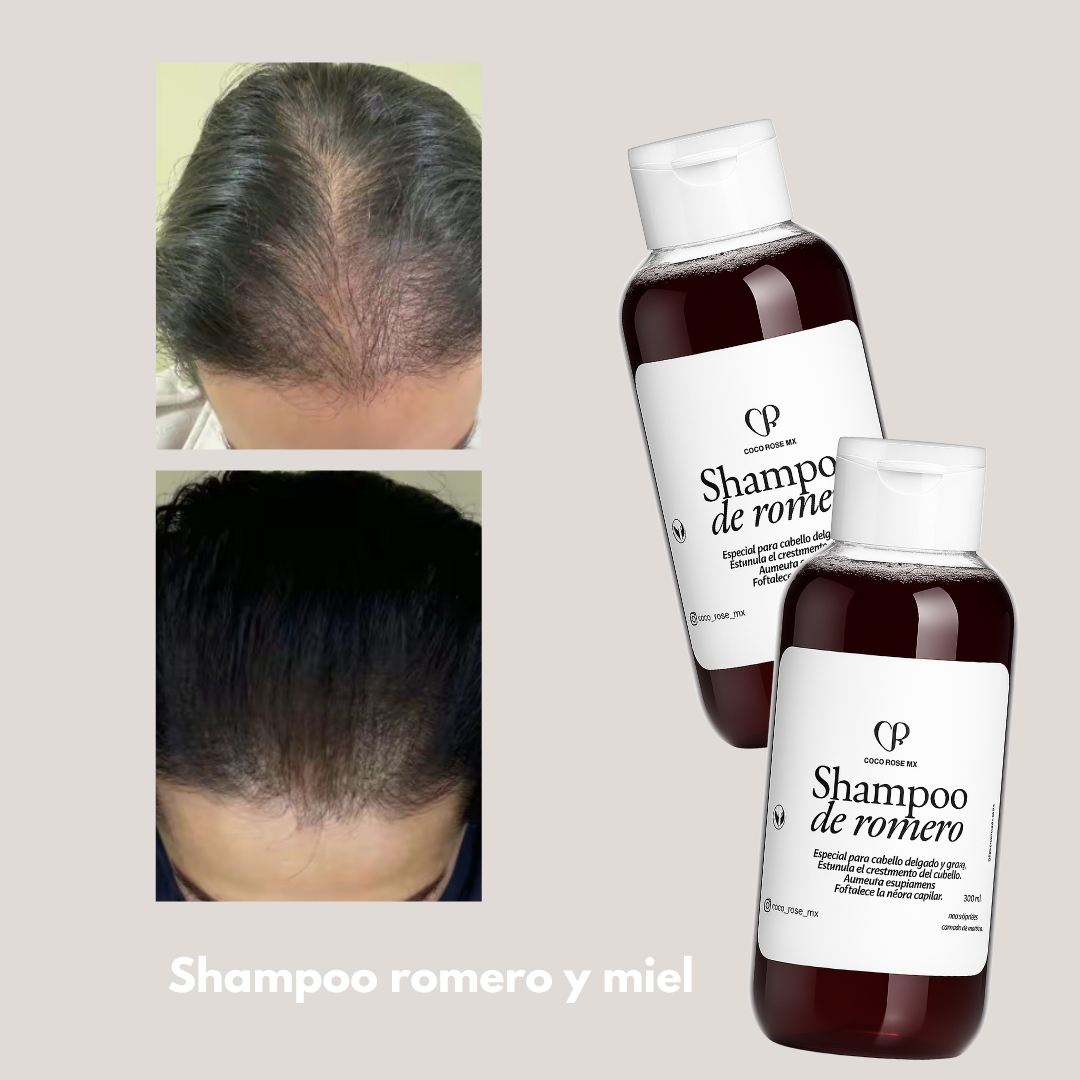 Dúo nutricion romero y miel 🍯 (CABELLO FINO y graso)
