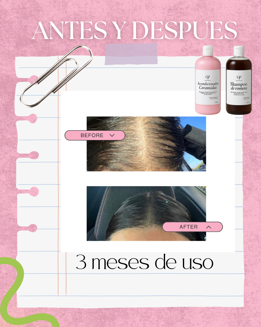 2x1 SHAMPOO DE ROMERO Y  MIEL ( cabello fino y caida)