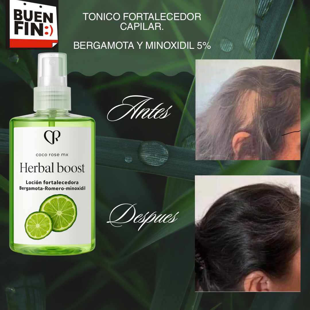 Tónico capilar estimulador de crecimiento y regulador de sebo (bergamora romero y minoxidil 5%)