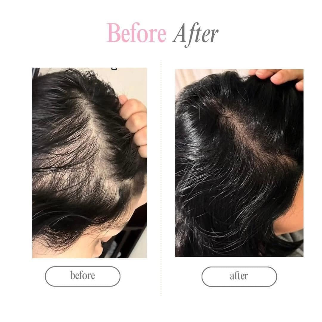 DUO CRECIMIENTO Y REPARACION