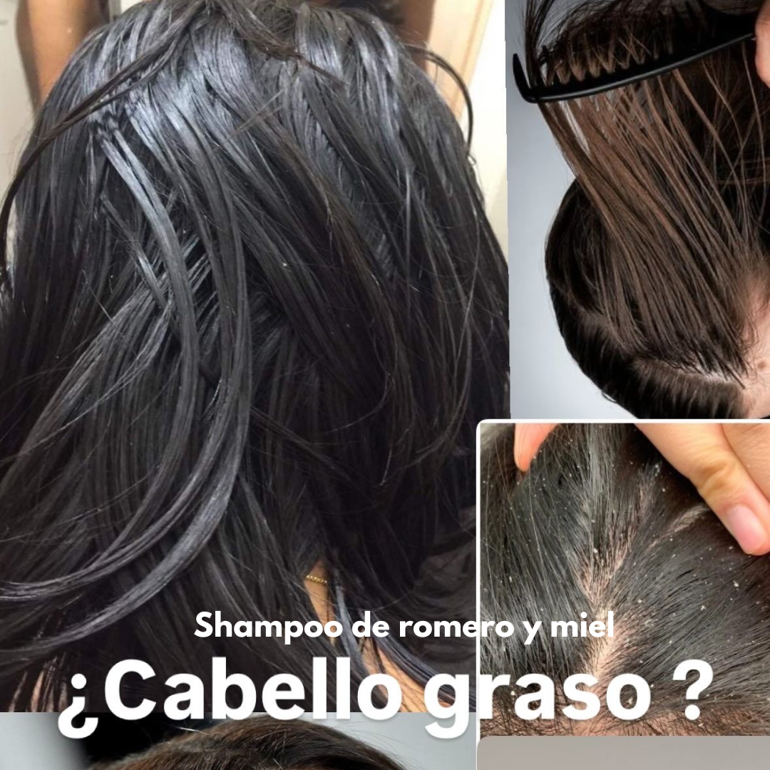 Dúo nutricion romero y miel 🍯 (CABELLO FINO y graso)