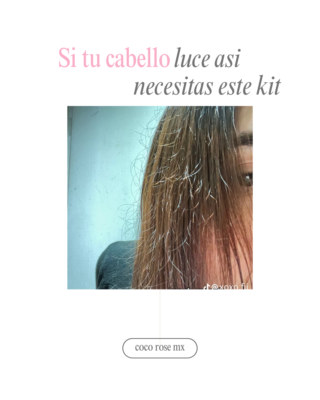 Kit crecimiento + control frizz
