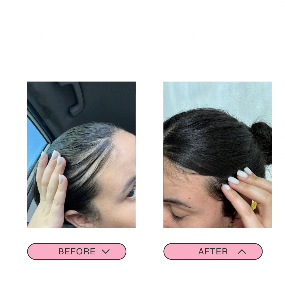 Shampoo de cebolla+ biotina 🧅💕