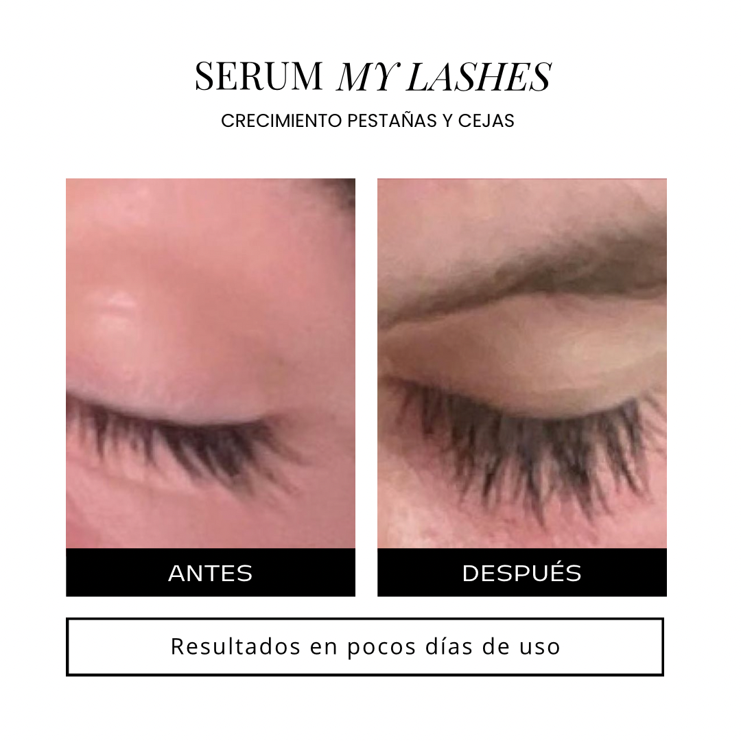 🎁My lashes-Serum para pestañas y cejas 🎀