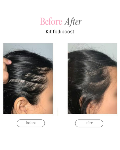 Kit Folliboost “Impulso Máximo de crecimiento”🍃