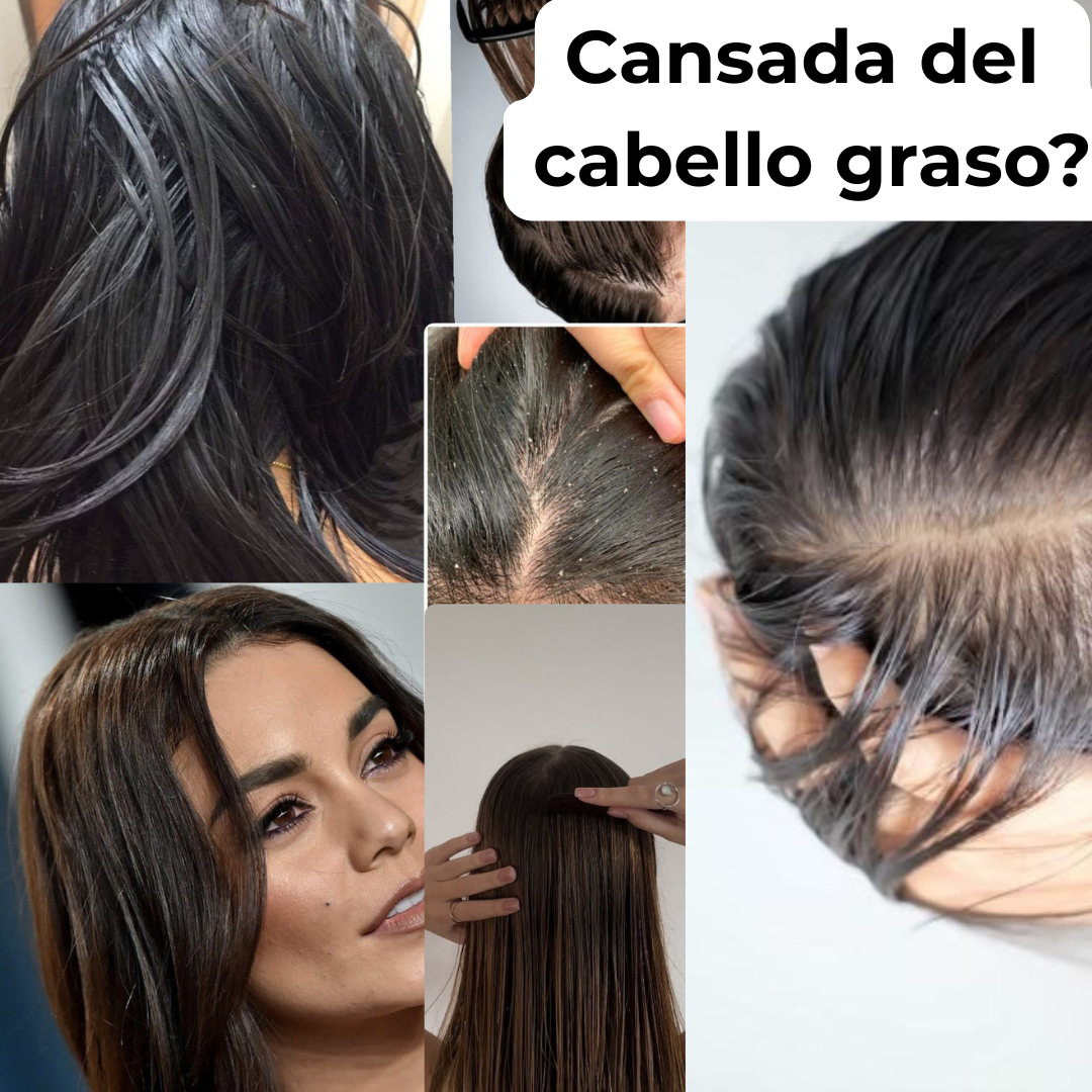 Tónico capilar estimulador de crecimiento y regulador de sebo (bergamora romero y minoxidil 5%)