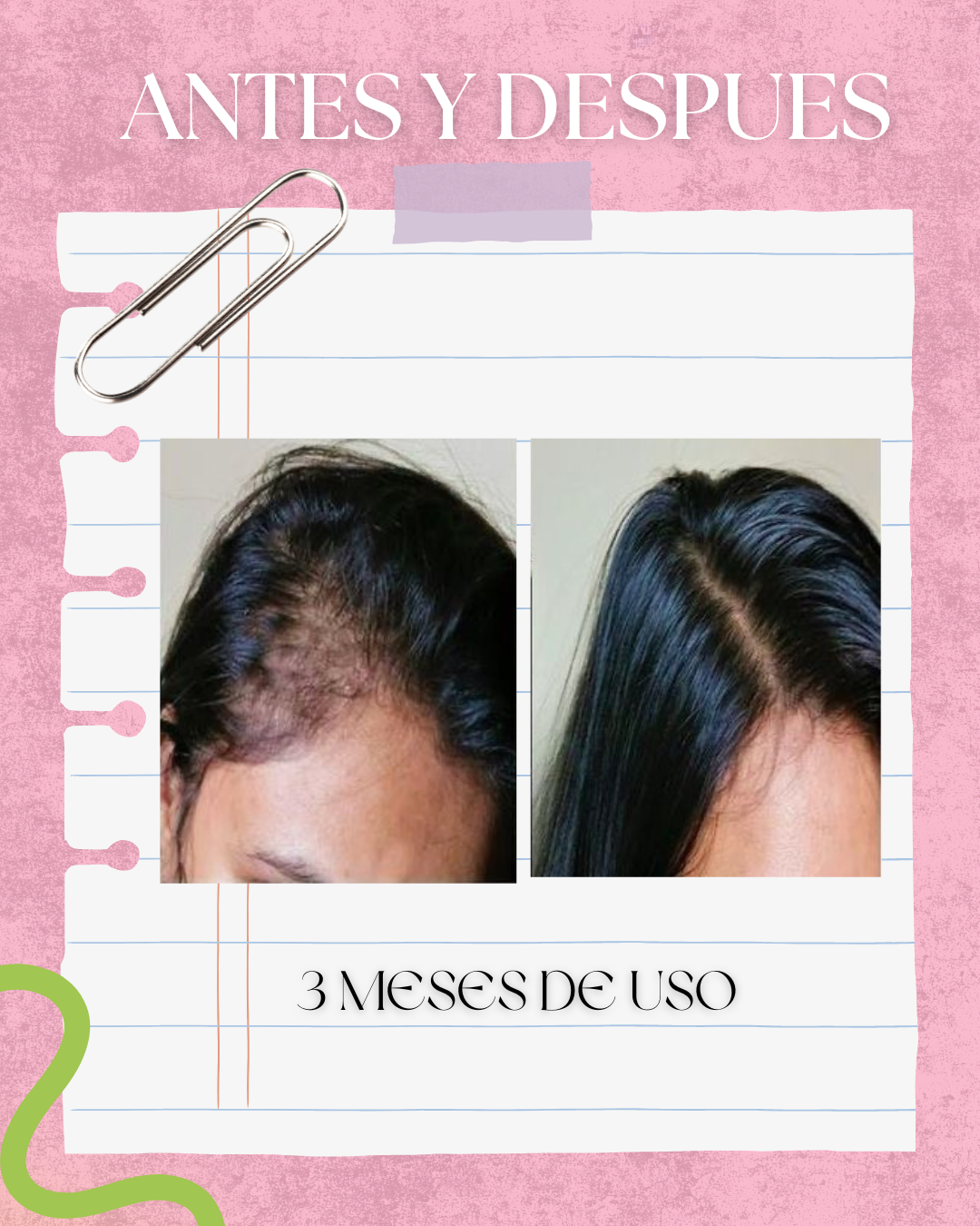 Dúo nutricion romero y miel 🍯 (CABELLO FINO y graso)