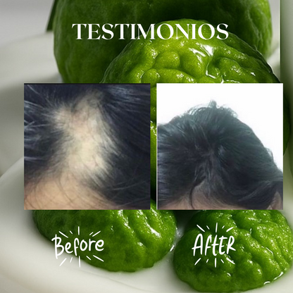 Kit Folliboost “Impulso Máximo de crecimiento”🍃