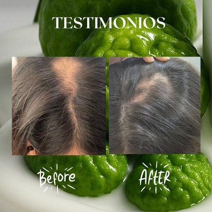 Kit Folliboost “Impulso Máximo de crecimiento”🍃