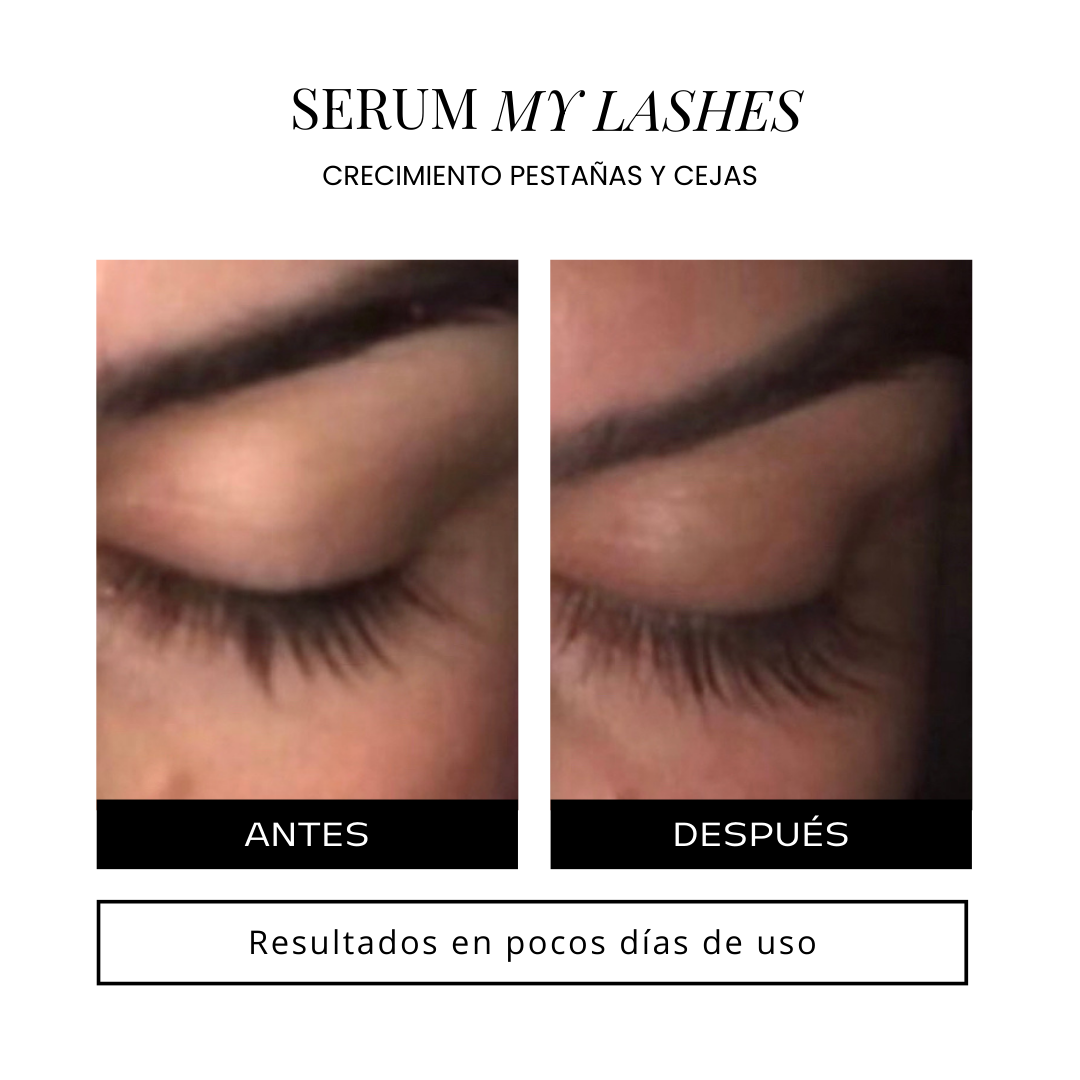 🎁My lashes-Serum para pestañas y cejas 🎀