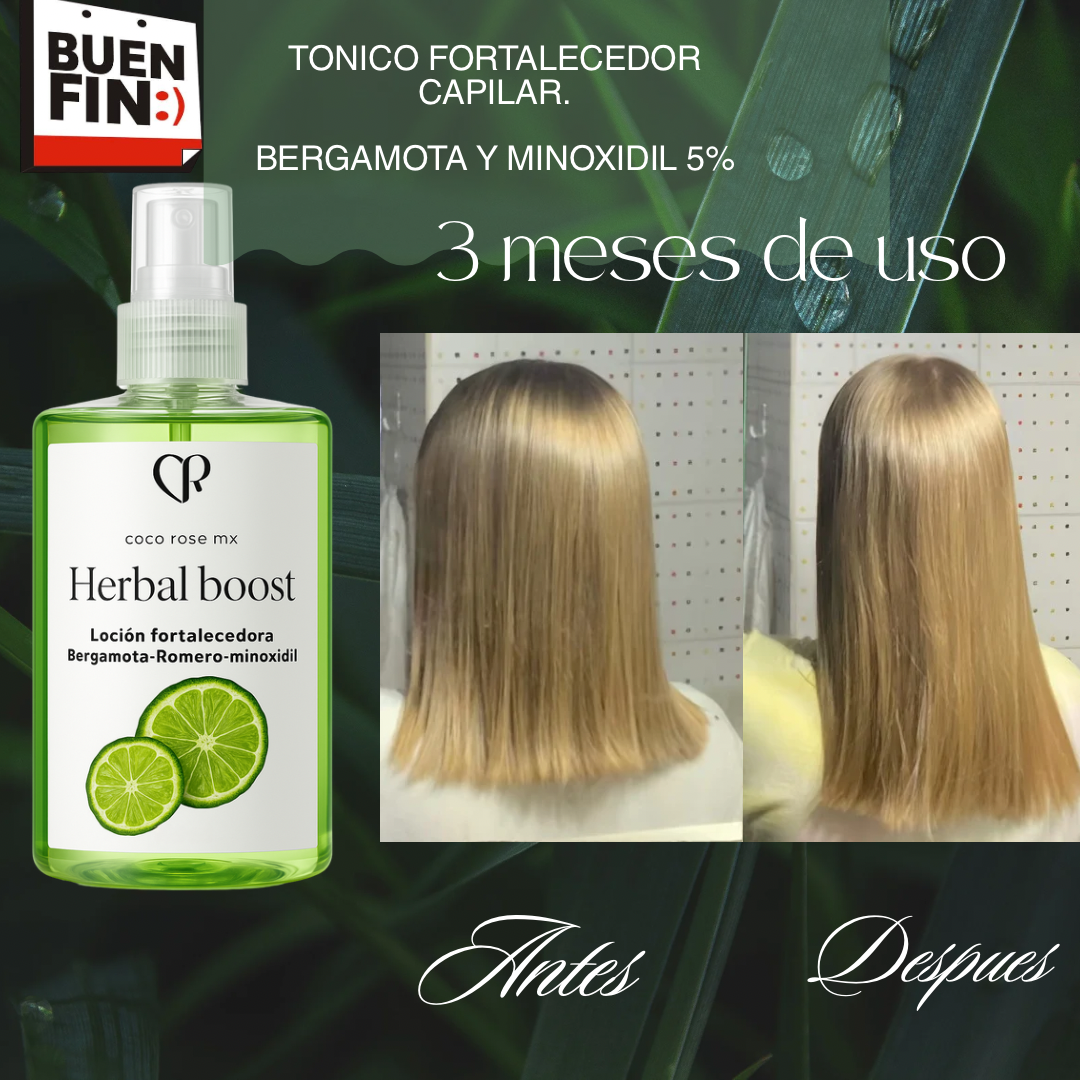 Kit Folliboost “Impulso Máximo de crecimiento”🍃