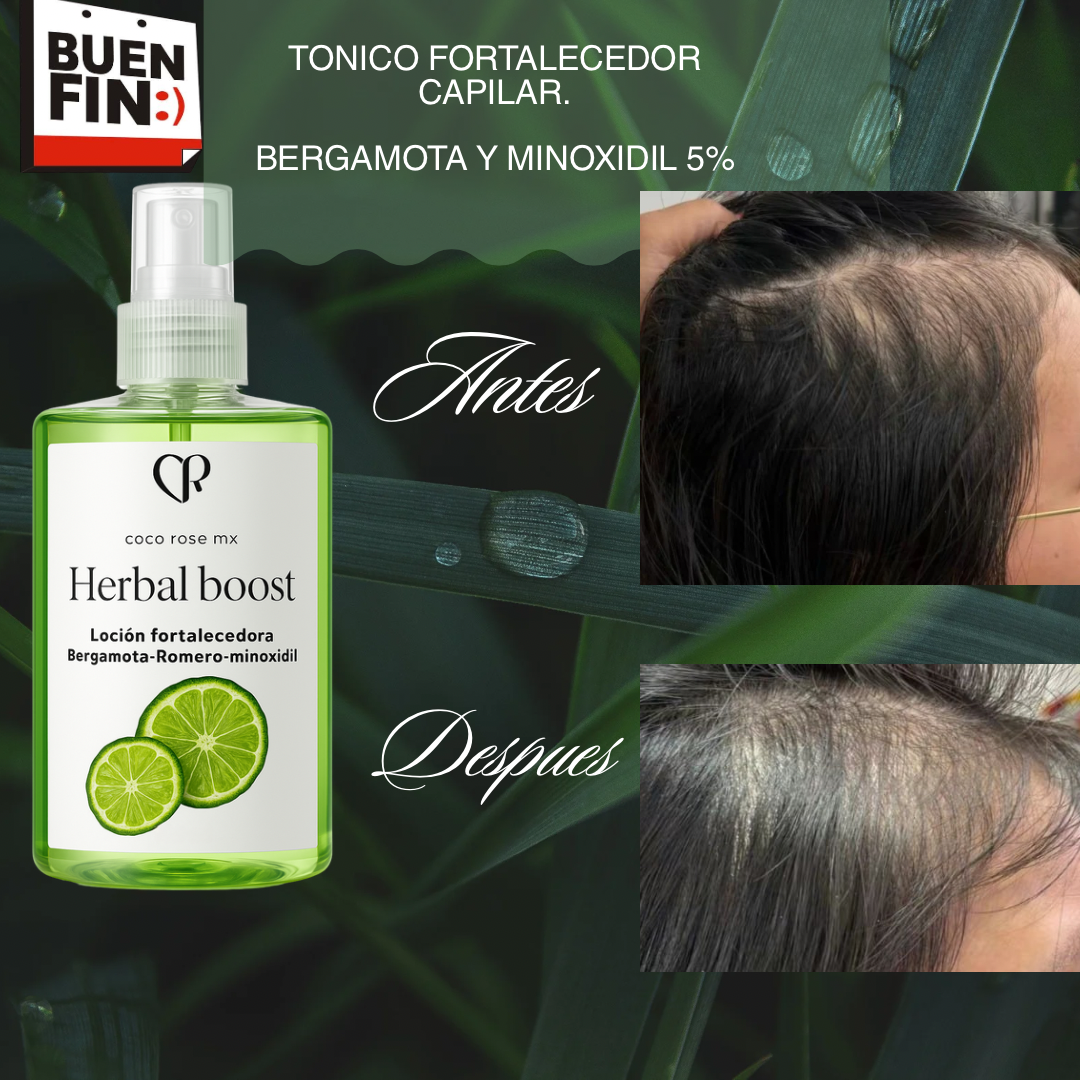 Tónico capilar estimulador de crecimiento y regulador de sebo (bergamora romero y minoxidil 5%)