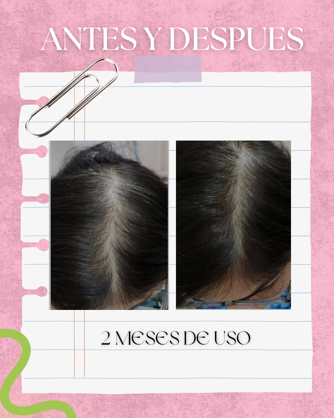 Dúo nutricion romero y miel 🍯 (CABELLO FINO y graso)