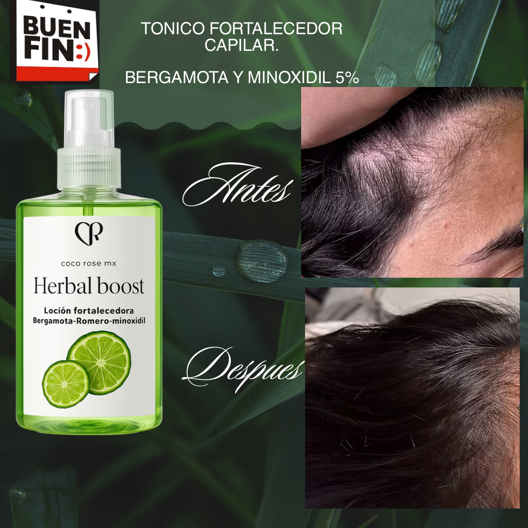 Tónico capilar estimulador de crecimiento y regulador de sebo (bergamora romero y minoxidil 5%)