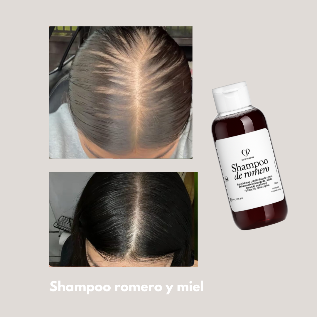 Dúo nutricion romero y miel 🍯 (CABELLO FINO y graso)