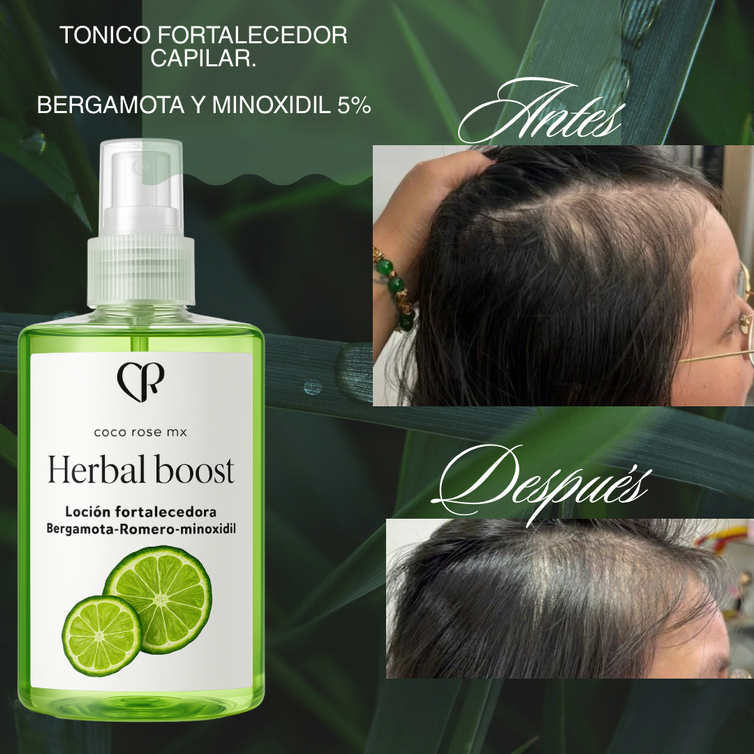 Kit Folliboost “Impulso Máximo de crecimiento”🍃