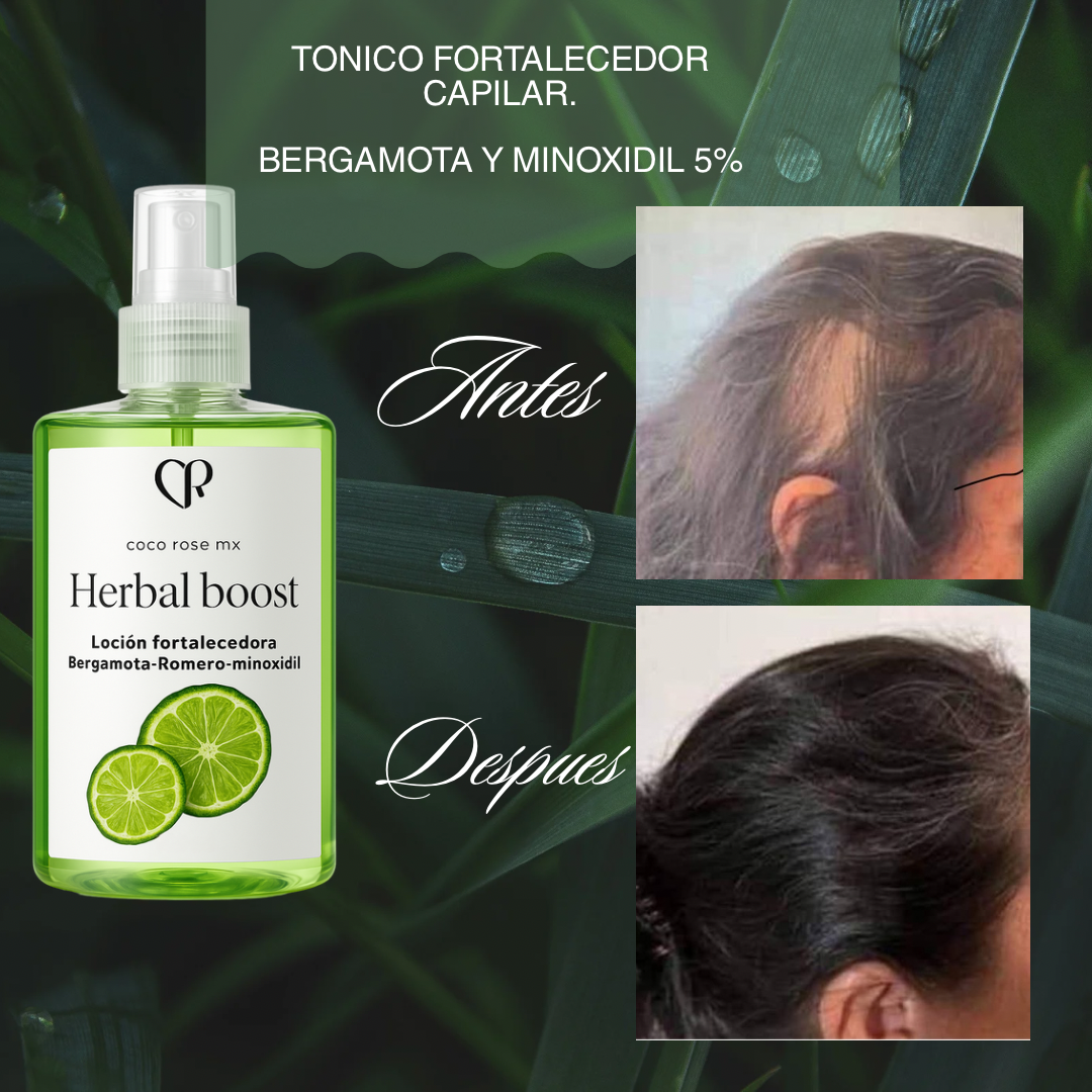 Kit Folliboost “Impulso Máximo de crecimiento”🍃