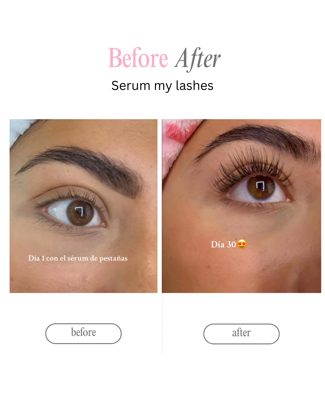 Serum My Lashes – Pestañas Más Largas en 4 Semanas🩷 ‼️