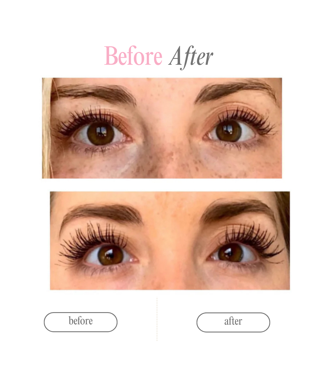 Serum My Lashes – Pestañas Más Largas en 4 Semanas🩷 ‼️