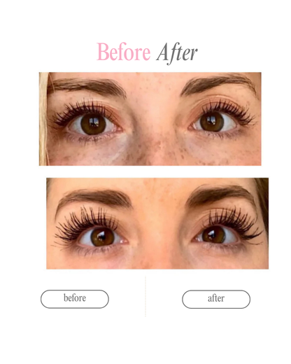 Serum My Lashes – Pestañas Más Largas en 4 Semanas🩷 ‼️
