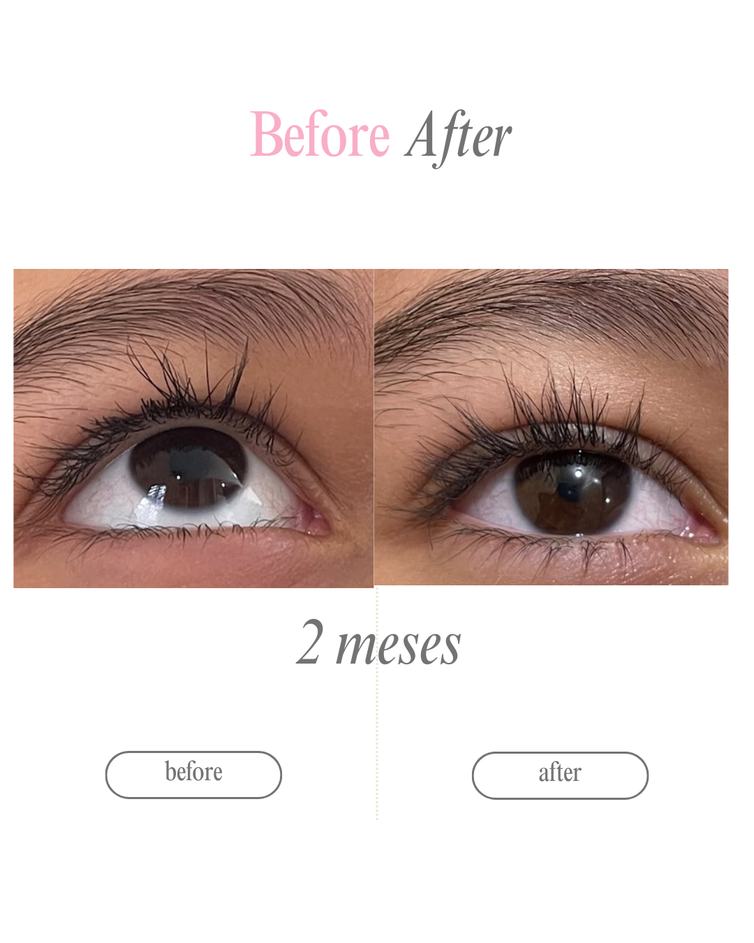 Serum My Lashes – Pestañas Más Largas en 4 Semanas🩷 ‼️